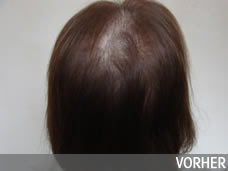 Vorher